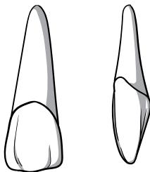 HBL95e5ce7a203131052fc3ddb91b93b0aa-img.jpg